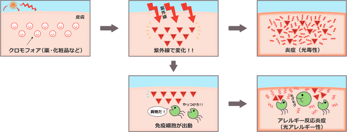 気をつけたい紫外線の肌トラブル ひまわり薬局 北海道保健企画