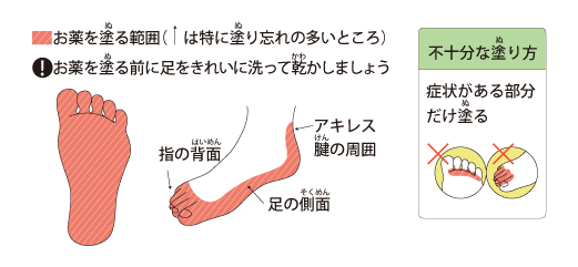 水虫の予防と治療 ひまわり薬局 北海道保健企画