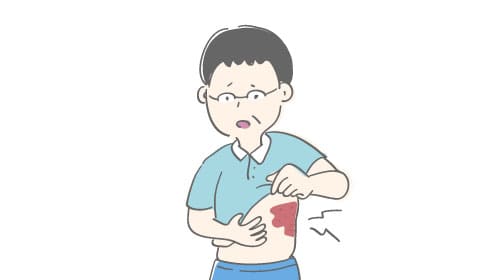 帯状疱疹で痛そうにしている男性
